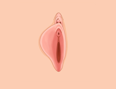 한쪽이 더 큰 소음순