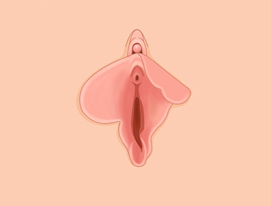 불균형 소음순